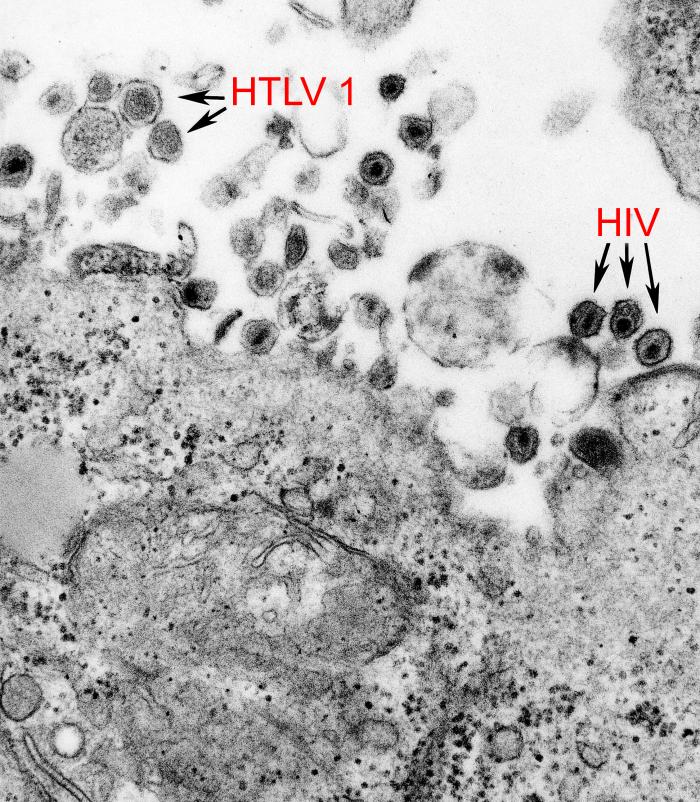 ¡Nueva publicación sobre coinfección por VIH y HTLV-1!