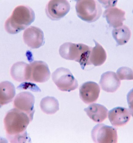 ¡Nueva publicación sobre antígenos de malaria!