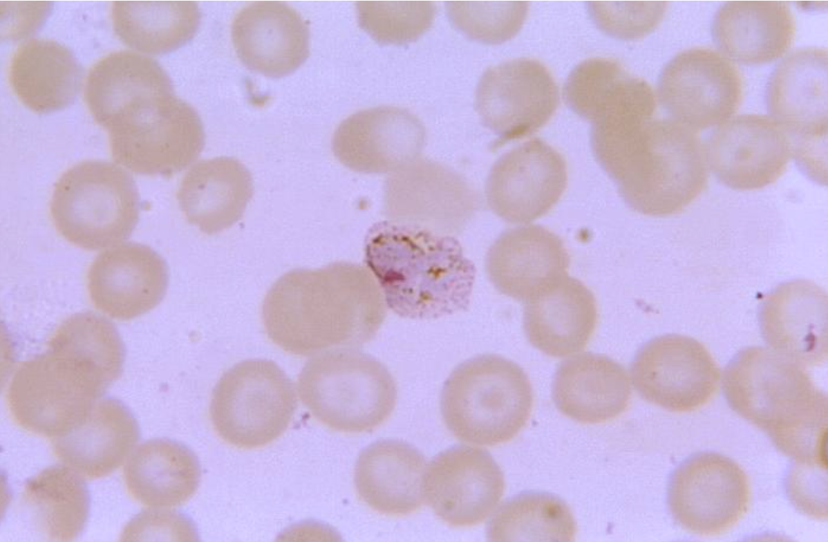 ¡Nueva publicación sobre primaquina y malaria!