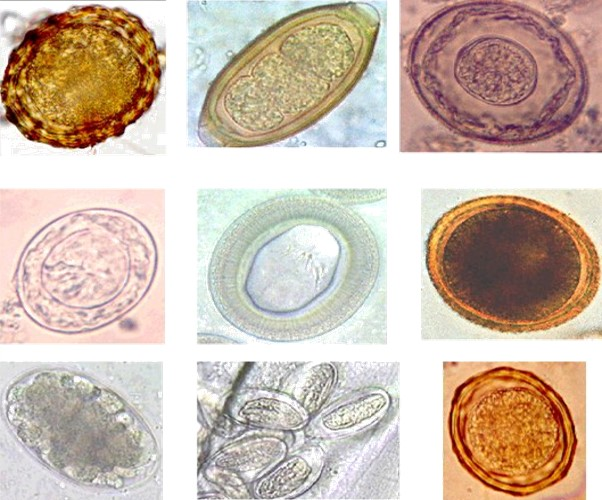 ¡Nueva publicación sobre uso de microscopios portátiles para el diagnóstico de helmintos!