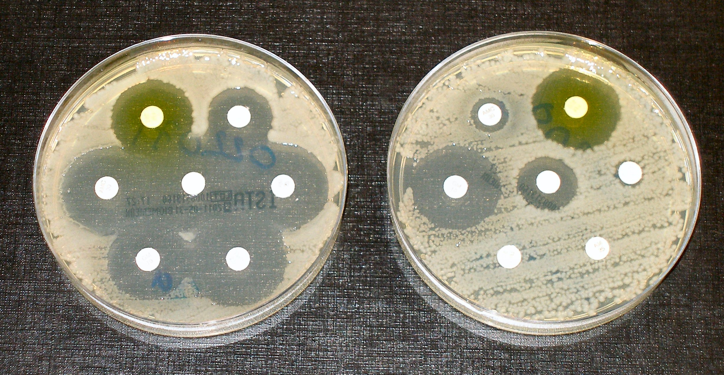  ¡Nueva publicación sobre prevalencia de resistencia antimicrobiana en gram negativos!