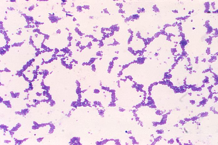 ¡Nueva publicación sobre bacteremia por MRSA!