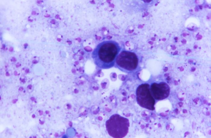 ¡Nueva publicación sobre un virus que infecta al parásito Leishmania!