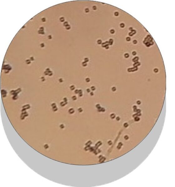 Bacterias_al_microscopio_óptico